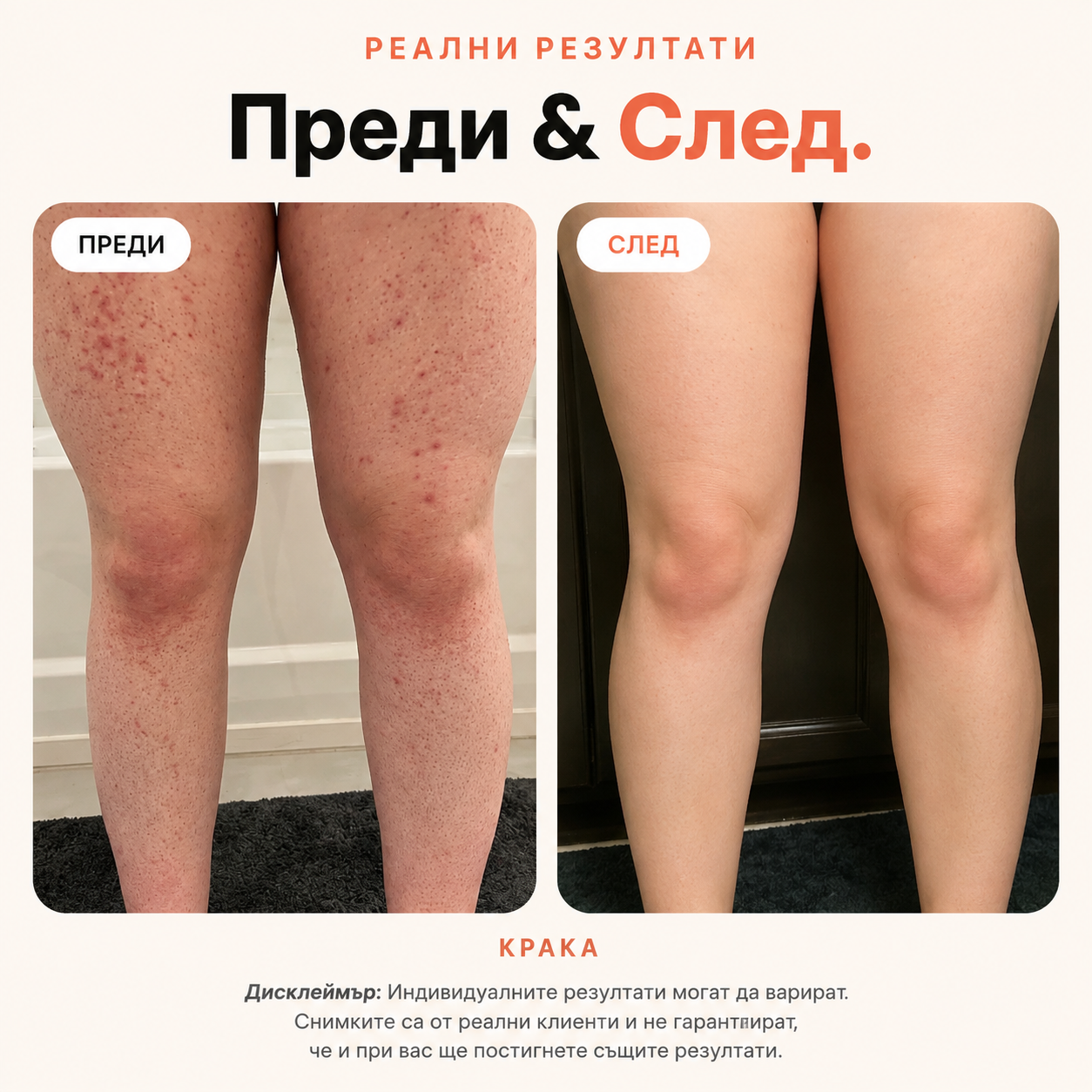 BBL Serum Гладка кожа. Без врастнали косъмчета.