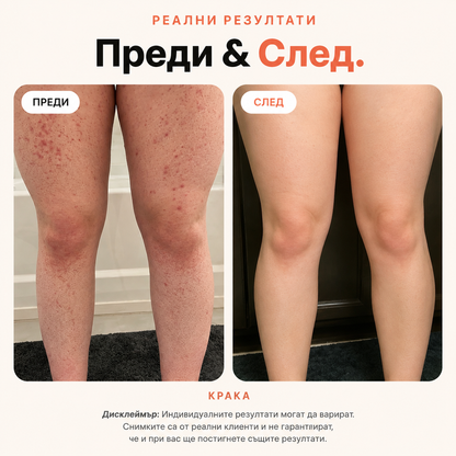 BBL Serum Гладка кожа. Без врастнали косъмчета.