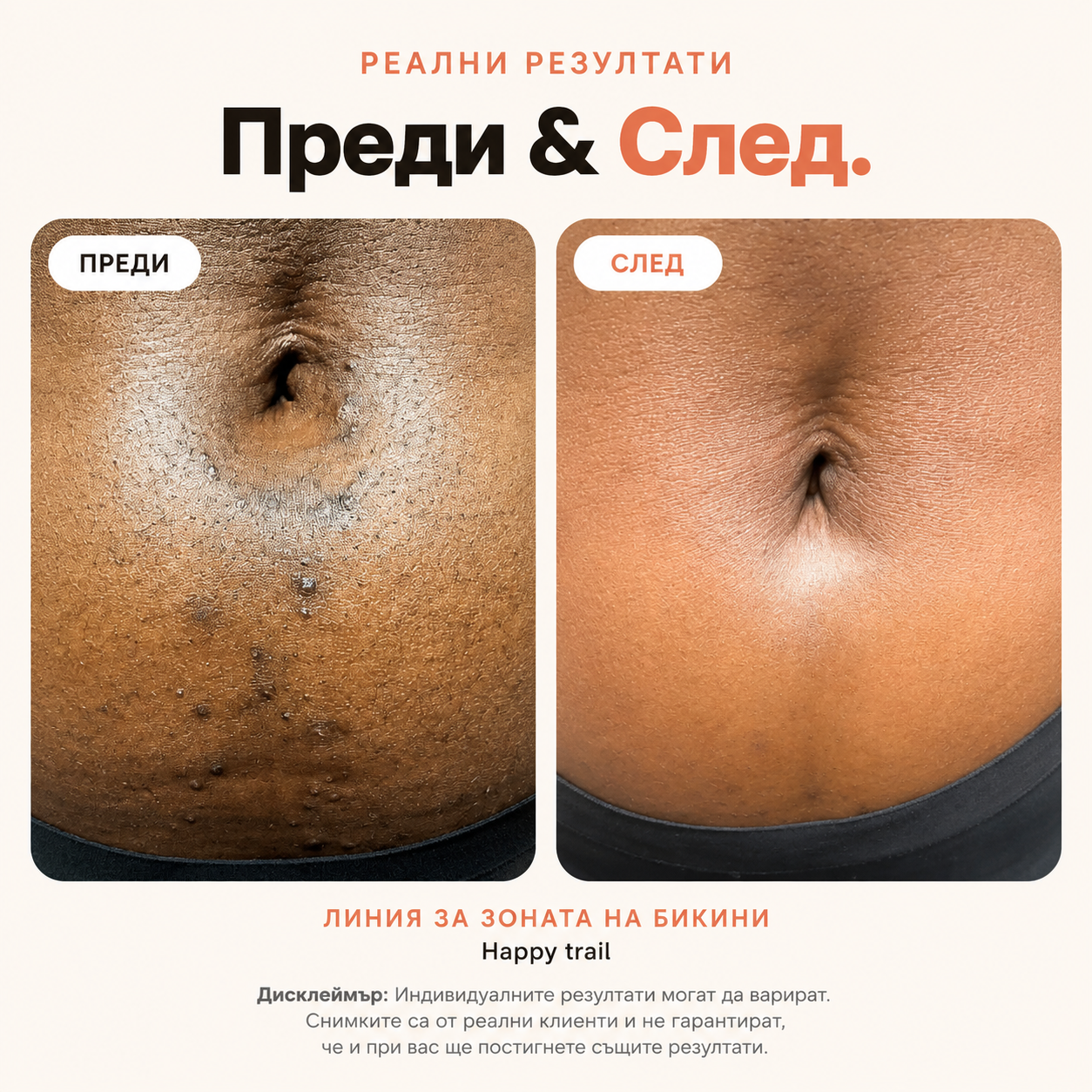 BBL Serum Гладка кожа. Без врастнали косъмчета.