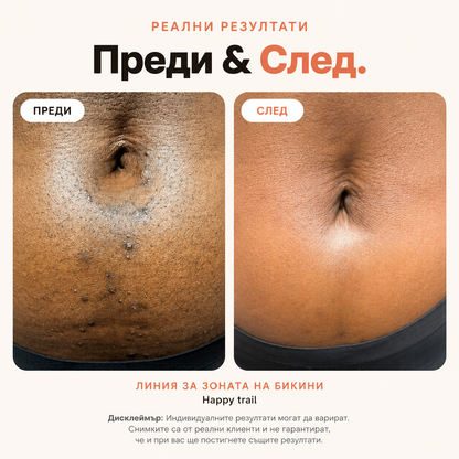 BBL Serum Гладка кожа. Без врастнали косъмчета.